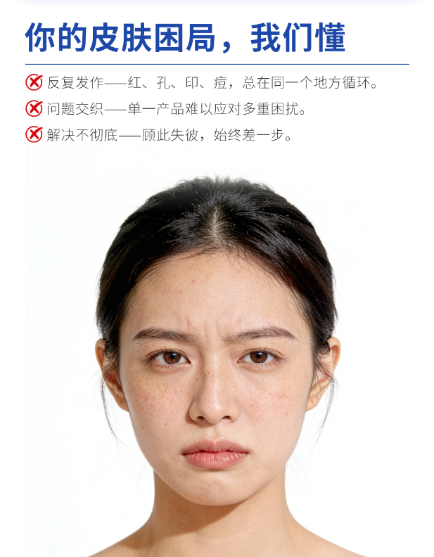 国家专利认证加持：珂蓝“净颜收孔专研凝胶”一瓶解决四大肌肤难题
